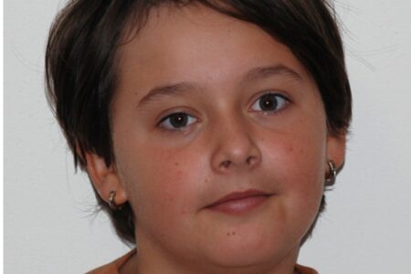 Asymetrie v obličeji